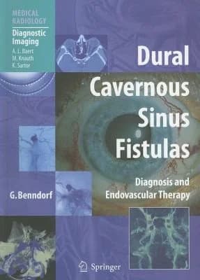Cover of Dural Cavernous Sinus Fistulas